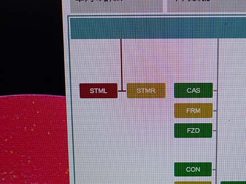 左側ヘッドライトのドライバーモジュール（TMS）と通信不能というエラーを確認