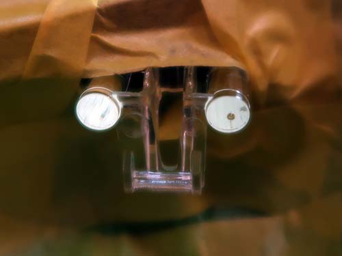 わずかに茶色く変色している