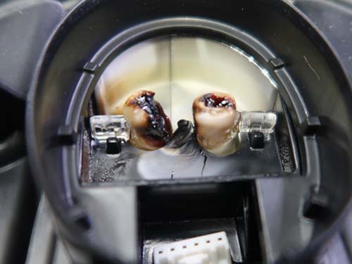 今まで見たことのないほど導光体が焼損しており、その下は白濁して溶解が大きく進行